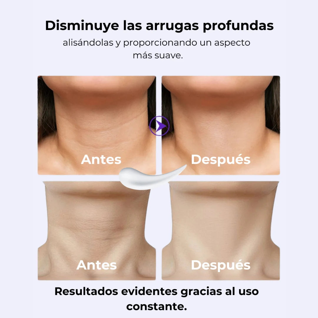 💜 GOPURE | REAFIRMANTE LIFTING PARA EL CUELLO| 50% OFF POR TU COMPRA DE HOY