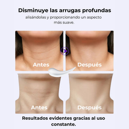 💜 GOPURE | REAFIRMANTE LIFTING PARA EL CUELLO| 50% OFF POR TU COMPRA DE HOY